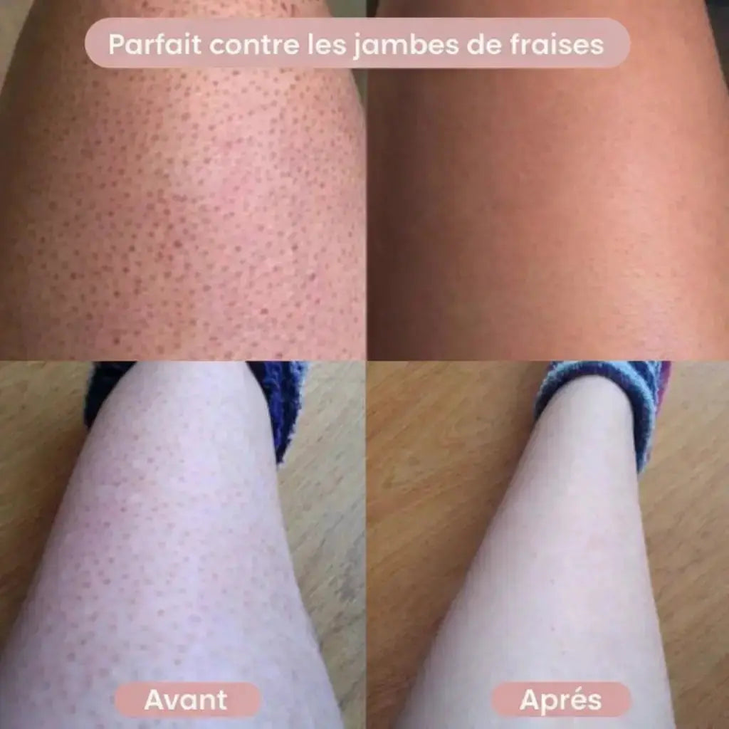 Épilateur Électrique Femme 2-en-1 – Bikini et Zones Intimes GLLOW